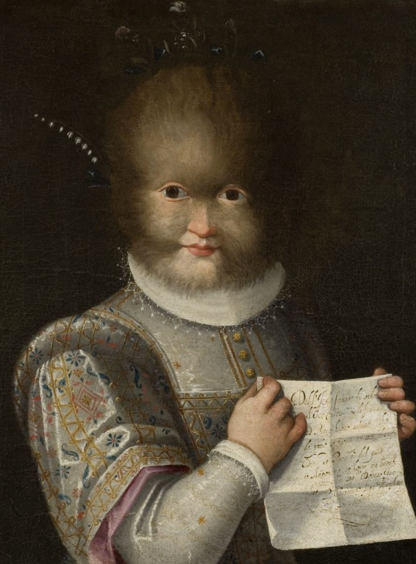 The Mystery of Antonietta Gonsalvus : Hairy Face in Renaissance&nbsp;Art